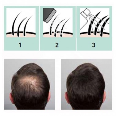 Fibras Capilares Hair Sculptor Castaño Oscuro- Aplicación - Sorci